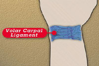Volar Carpal Ligament