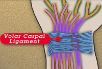 Carpal Tunnel Syndrome Treatment